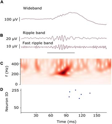 Automatic Detection of High-Frequency Oscillations With Neuromorphic Spiking Neural Networks